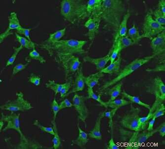 ISS Research Uncovers Significant Changes in Cultured Cardiac Stem Cells