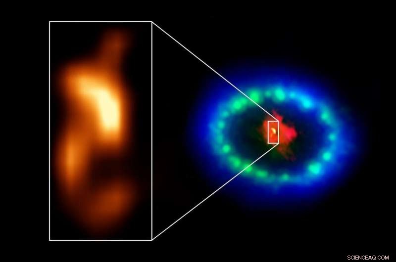 ALMA Detects Possible Neutron Star Signature in Supernova 1987A