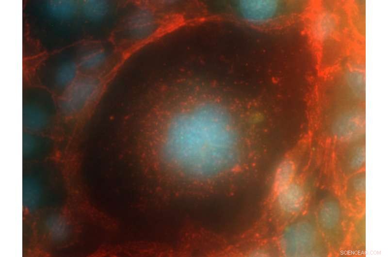 Space‑borne Human Endothelial Cell: Insights into Astronaut Health