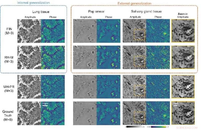 Accelerated Holographic Imaging of Biological Samples Using End-to-End Neural Networks