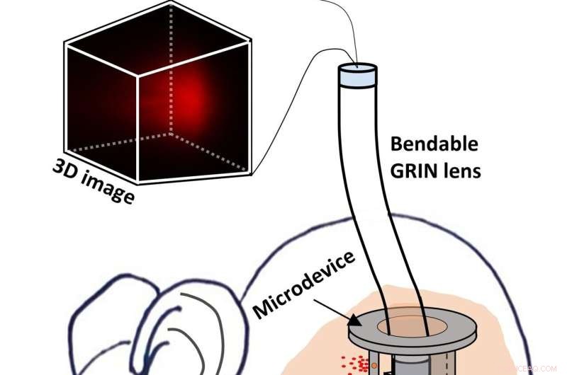 Revolutionary Endoscope with Bendable GRIN Lens Captures 3D Microscopy Images