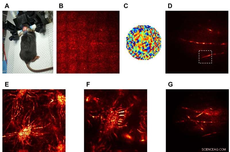 Revolutionary Holographic Microscope Enables Non-Invasive Imaging of the Mouse Brain
