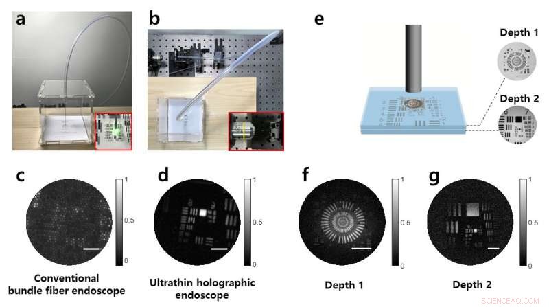 Revolutionary Ultrathin Flexible Endoscope: Thinner Than a Needle