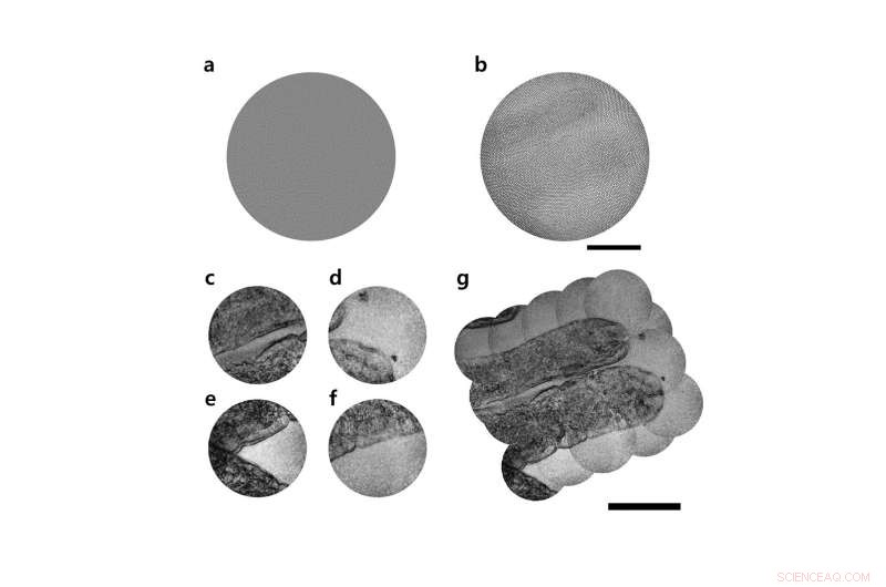 Revolutionary Ultrathin Flexible Endoscope: Thinner Than a Needle