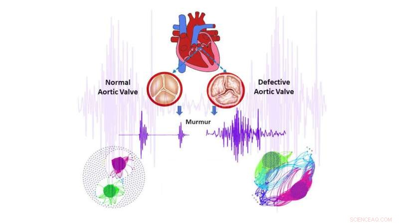 Low-Cost Heart Sound Mapping: Accurate Early Detection of Aortic Valve Stenosis