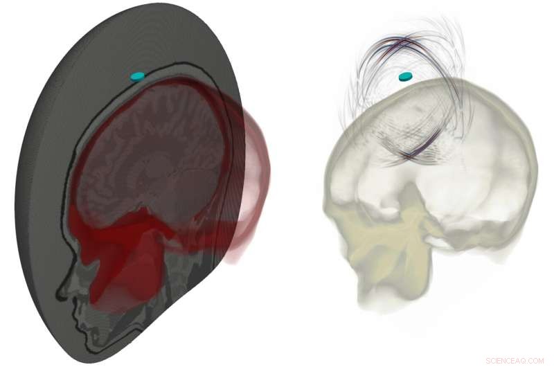 Ultrasound Brain Imaging: Advanced Techniques for Precise Neural Mapping