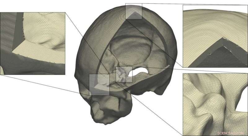 Ultrasound Brain Imaging: Advanced Techniques for Precise Neural Mapping