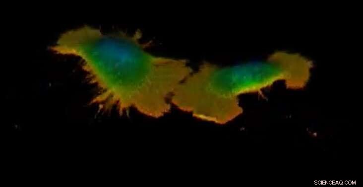 Scientists Discover Cells Travel Faster Through Mucus Than Blood