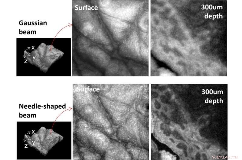 New Laser Beam Shaping Method Enhances OCT Imaging Depth and Resolution