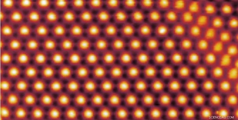 Exceptional Superconductivity Revealed in Magic-Angle Twisted Trilayer Graphene