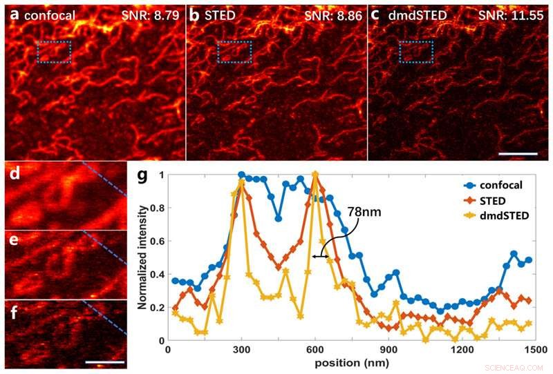 Enhancing Cellular Imaging: Frequency-Domain STED Microscopy for Targeted Background Noise Reduction