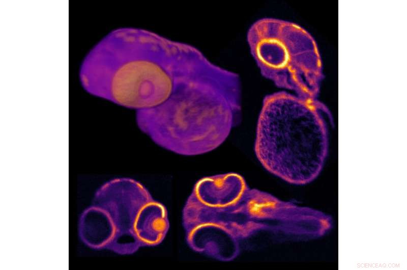 Revolutionizing Biomedical Imaging: Enhanced OCT Delivers Higher Contrast, Resolution, and 3D Field of View
