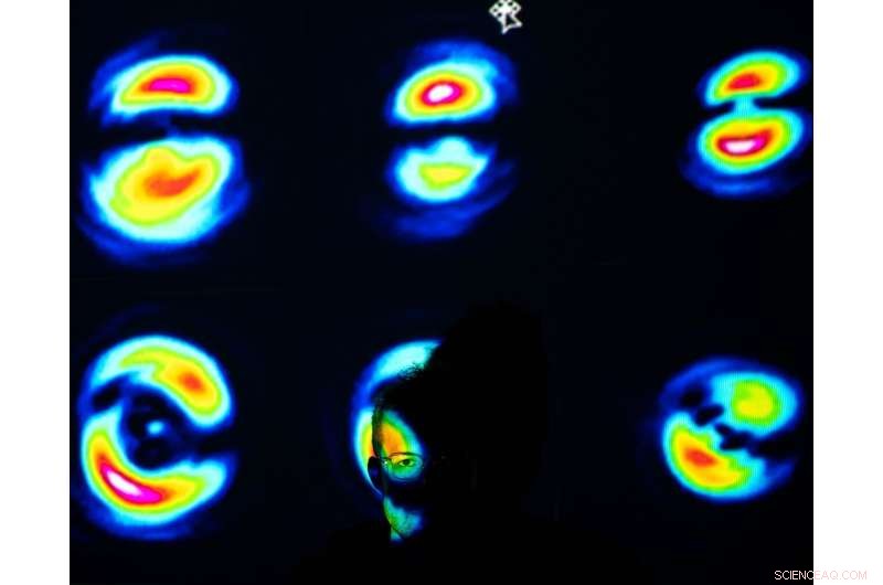 Noise-Free OCT Imaging: A Breakthrough for Early Eye Disease Detection