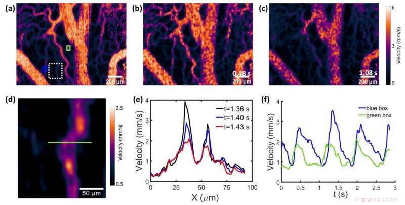 Advanced Confocal Laser Speckle Autocorrelation Imaging Reveals Dynamic Blood Flow in Microvasculature