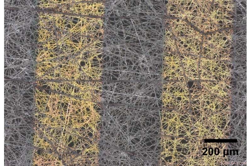 Ultra‑Thin Mesh Technology Enhances Wearable Medical Sensors