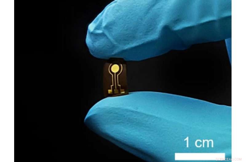 Flexible Implantable Sensor Detects Early Osteoarthritis via Nitric Oxide