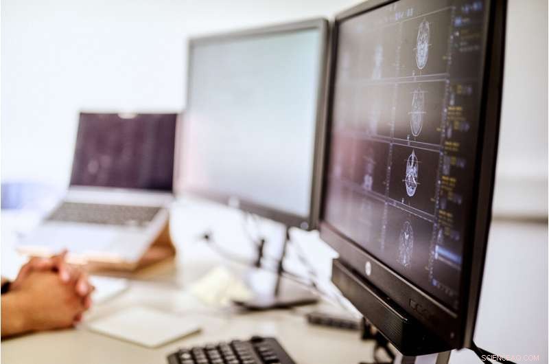 Advanced AI Algorithms for Precise MRI Data Analysis