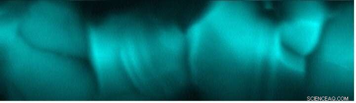 Unveiling Microscopic Carrier Loss in 12% Efficient Kesterite Solar Cells