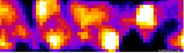 Unveiling Microscopic Carrier Loss in 12% Efficient Kesterite Solar Cells