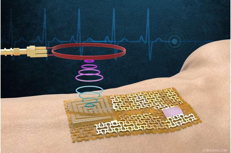 MIT Engineers Develop Chip-Free Wireless Electronic Skin for Real-Time Health Monitoring