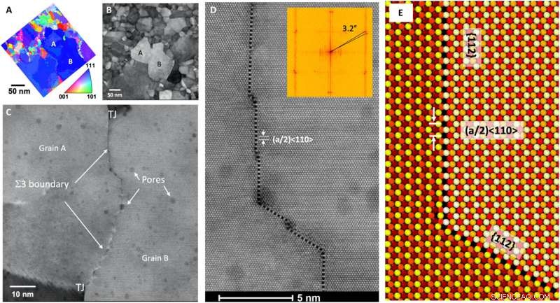 Unraveling How Radiation Diminishes Metals: An Atomic-Level Investigation