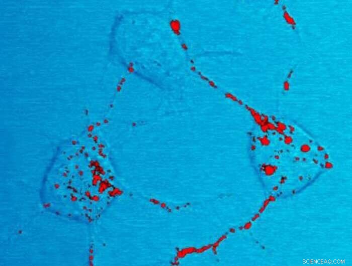 Breakthrough: New Therapeutic Target Identified for Prion Diseases