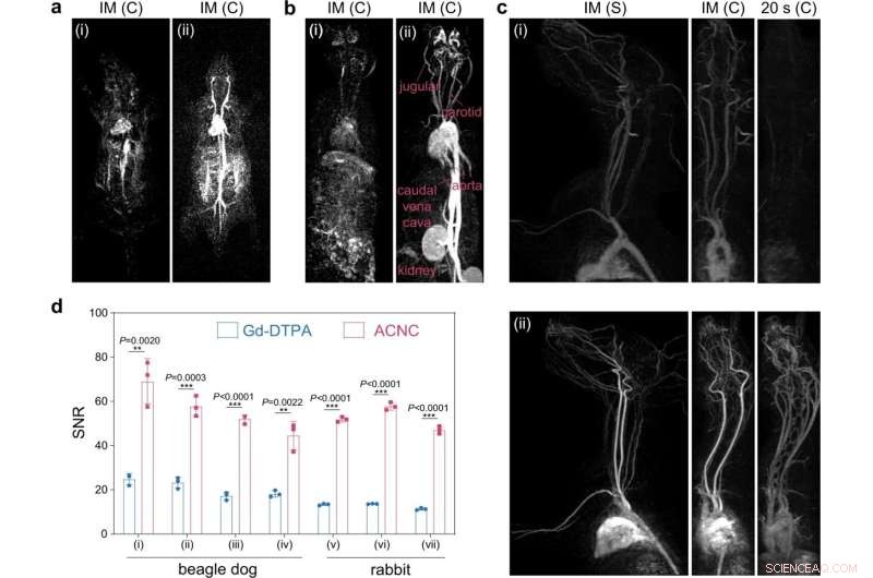 Unlock Fourfold MRI Contrast Gains with a Simple, Proven Protocol