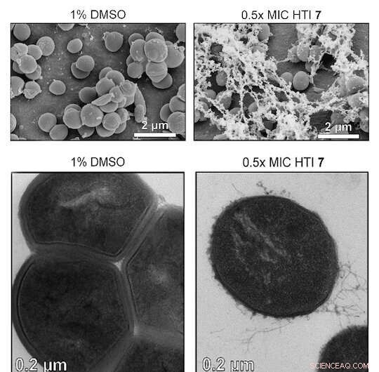 Light-Activated Molecular Motors Offer New Approach to Combat Antibiotic-Resistant Bacteria