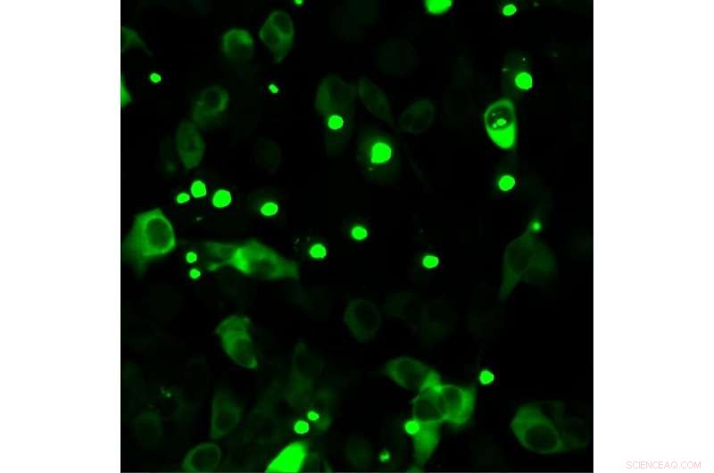 Breakthrough Findings Shed Light on Huntington s Disease Pathogenesis