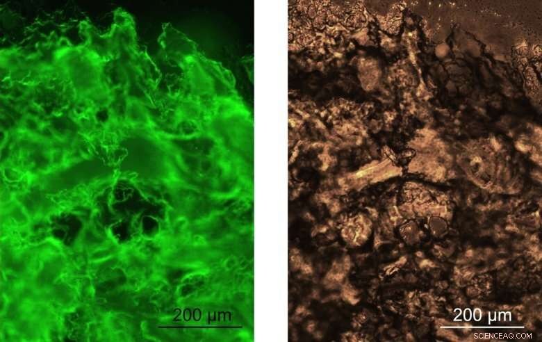 Breakthrough: Spider Silk Protein Gel for Advanced Biomedical Applications
