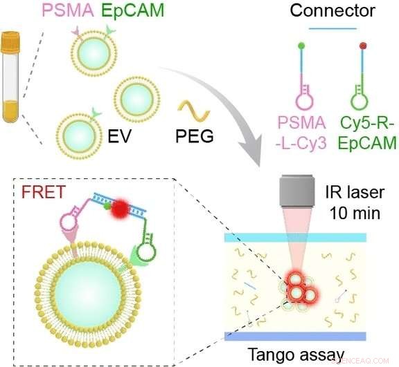 Rapid, Accurate Blood Test for Prostate Cancer Detection