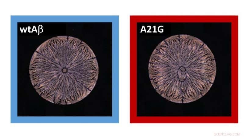 Peptide Fingerprinting Advances Early Diagnosis of Alzheimer’s Disease