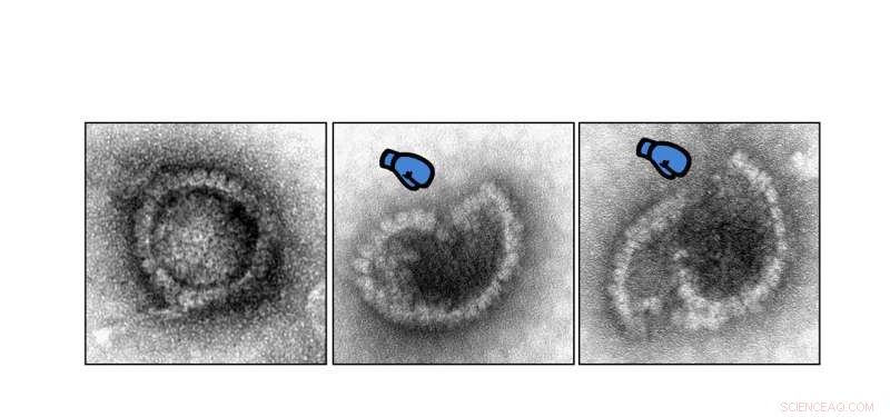 New Breakthrough: MxB Protein Targets Herpes Virus for Improved Antiviral Therapies