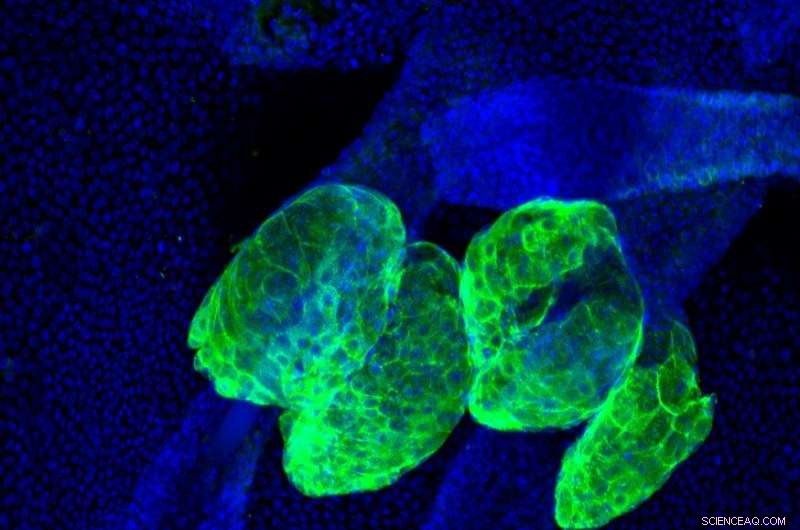 New Receptor Identified That Controls Sebaceous Gland Stem Cell Activity