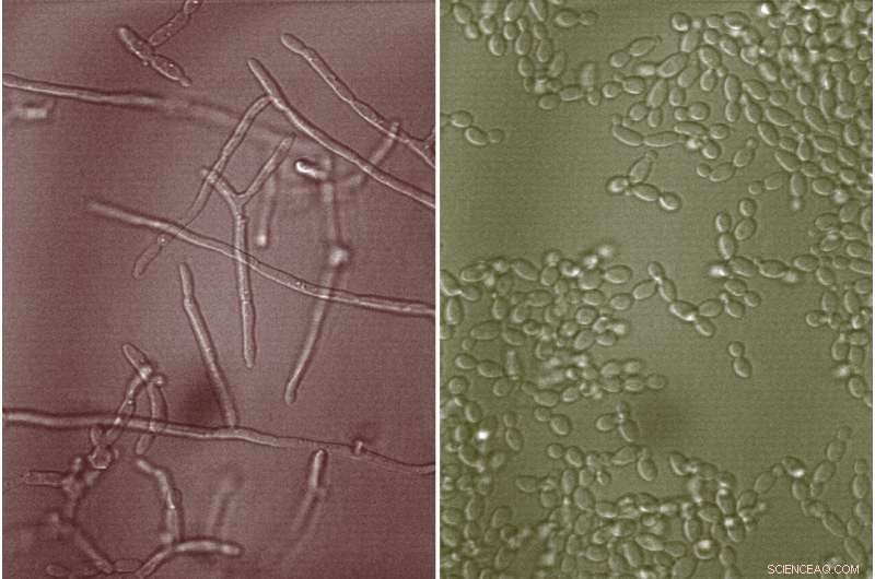 Mucus-Linked Molecules Block Candida albicans Infection