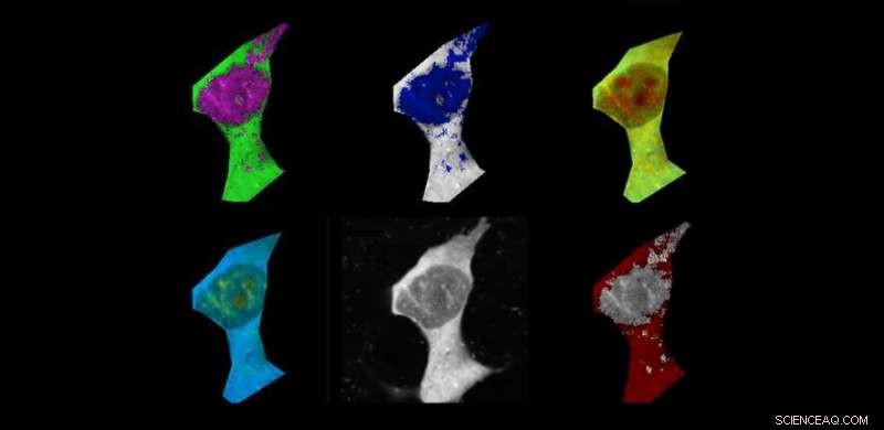 Alzheimer’s Disease Raises Cell Temperatures, Scientists Warn of Cellular  Overheating 