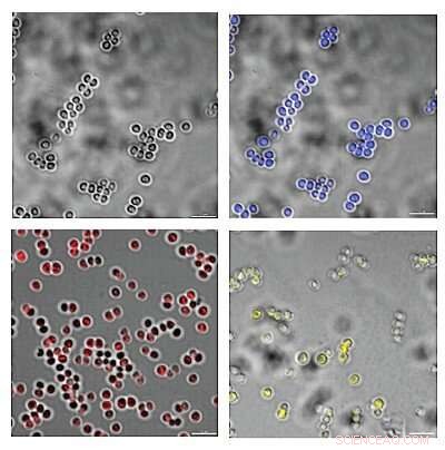 Affordable Paper-Based Sensor Accurately Identifies Pathogenic Bacteria