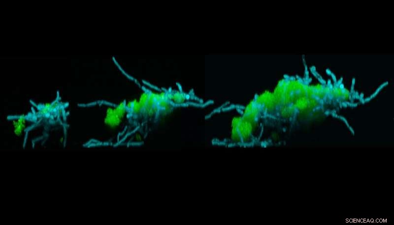 Research Finds Cavity‑Causing Microbes Form Superorganisms That Crawl and Spread on Teeth