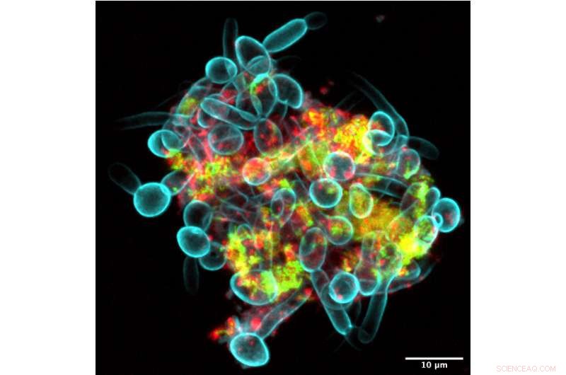 Research Finds Cavity‑Causing Microbes Form Superorganisms That Crawl and Spread on Teeth