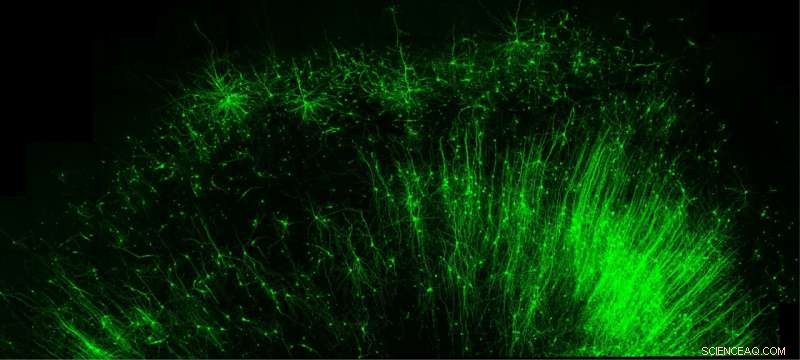 Duke’s CellREADR: An RNA Tool for Precise Brain Cell Targeting and Imaging