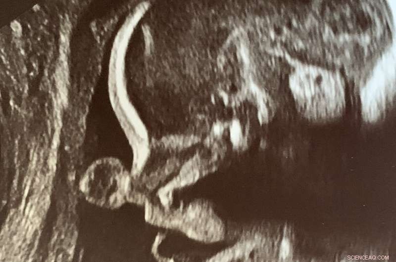 Study Reveals Accelerated Prenatal Growth in Hominids Following Divergence from Chimpanzees