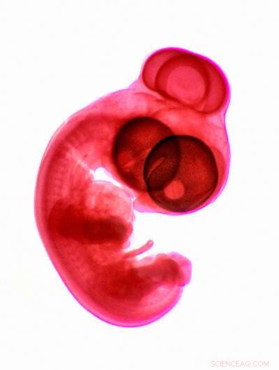 Mechanical Sensors Direct Cellular Organization in Vertebrate Eye Development