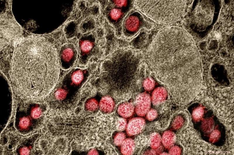 First Complete Model of SARS-CoV-2 Assembly Revealed