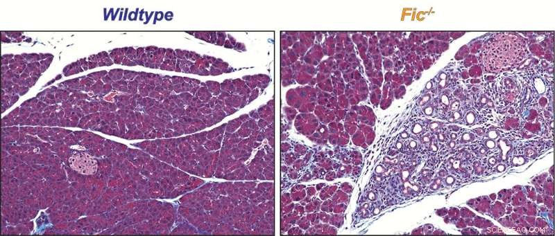 Fic Enzyme Identified as Key Regulator of Pancreatic Cellular Stress Response