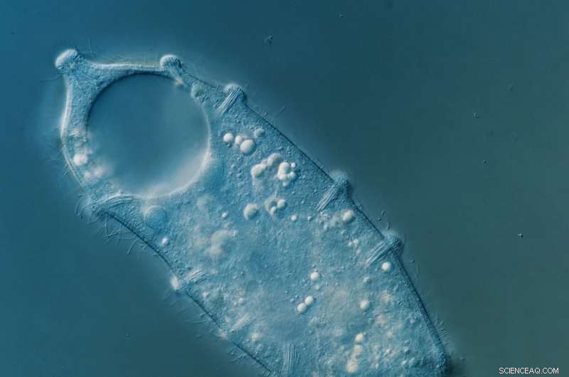 New Microscopic Species Discovery Broadens the Tree of Life