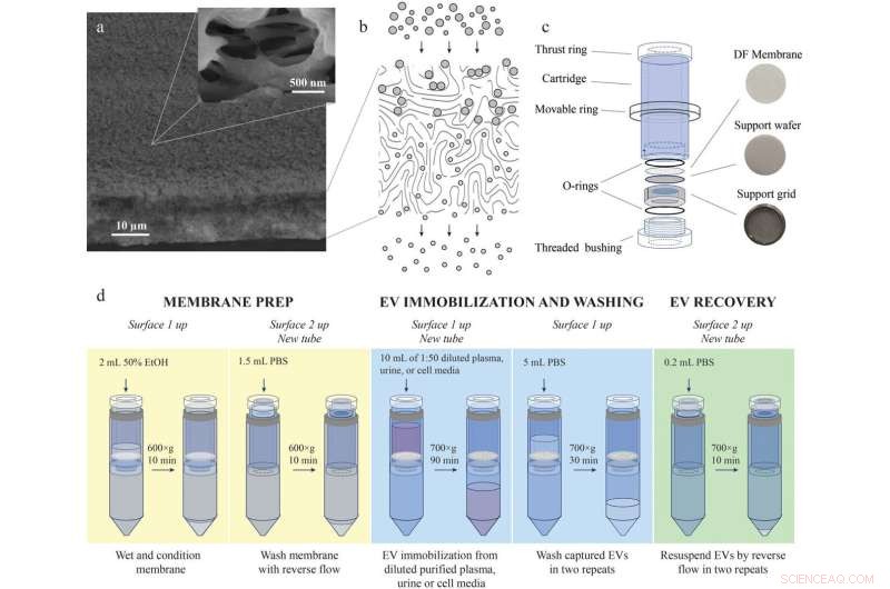 Advanced Extracellular Vesicle Capture: A Novel Filtration Method for Disease Marker Isolation