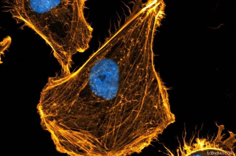 New Gene Unveils the Secrets of Cell Skeleton Development