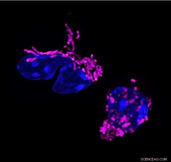 Mitochondrial Shape Shapes Immune Function: New Insights into T Cell Dynamics