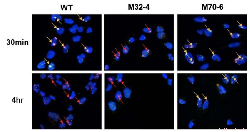 Scientists Uncover How RPA32/RPA70 Interact with XPA to Drive Nucleotide Excision Repair