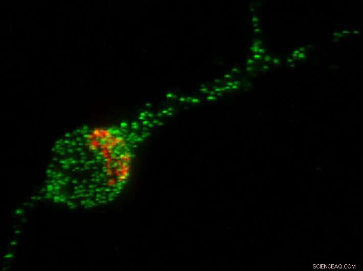 Groundbreaking Study Enables Testing of Treatments for Rare Pediatric Neurodegenerative Disease